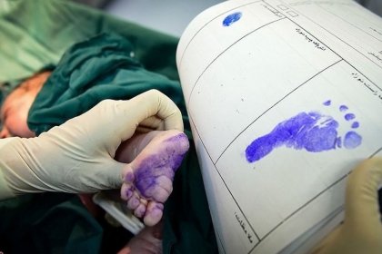 The Ministry of Health warns about scheduled cesarean sections
