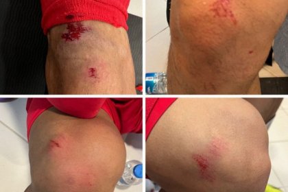 العشب الصناعي في الملعب تسبب في إصابة لاعبي المنتخب الإيراني